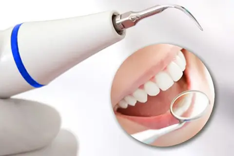 Что такое ультразвуковая чистка зубов и зачем она нужна