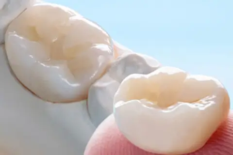 Как вернуть жевательную функцию и эстетику за короткий срок: протезирование зубов в «Crystal Dent»