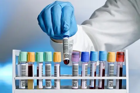 Тесты на инфекции: когда не стоит медлить