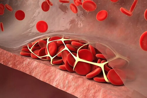 что такое коагулограмма