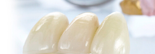 Керамические коронки 